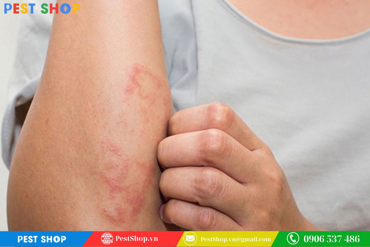 Dấu hiệu nhận biết kiến ba khoang đốt