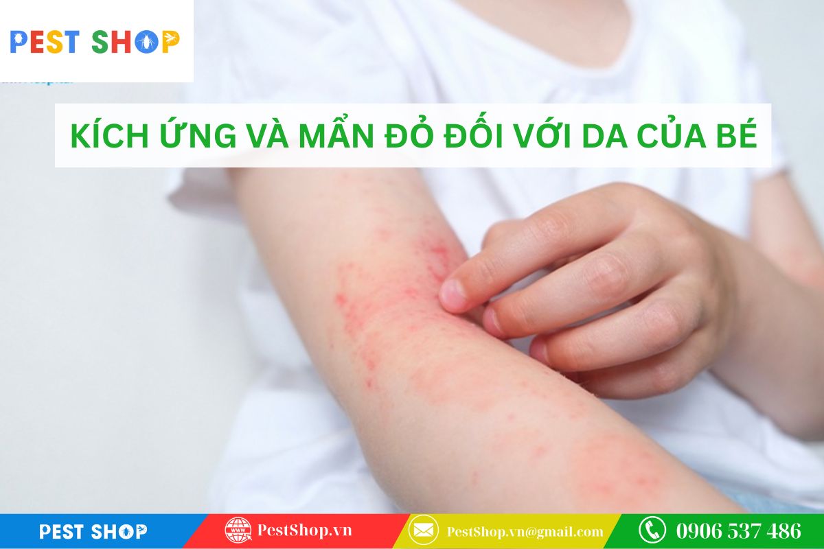 Nguy cơ kích ứng da và mẩn đỏ đối với làn da nhạy cảm của bé